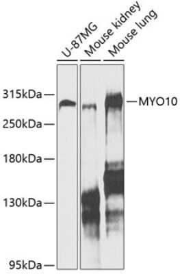 Western Blot: myosin X AntibodyBSA Free [NBP2-94085]