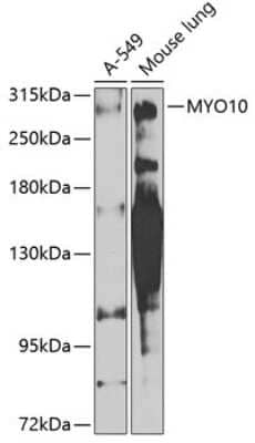 Western Blot: myosin X AntibodyBSA Free [NBP2-94658]