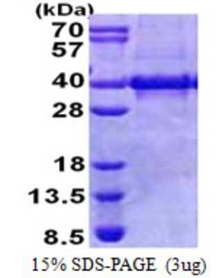 SDS-PAGE: Recombinant Human Myozenin 1 His Protein [NBP2-23256]