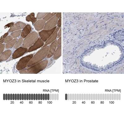 Immunohistochemistry-Paraffin: myozenin 3 Antibody [NBP1-90616]