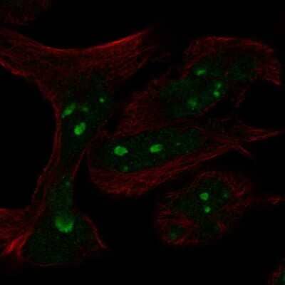 Immunocytochemistry/ Immunofluorescence: n-Myc Antibody [NBP2-56178]