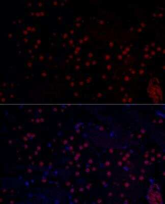 Immunocytochemistry/ Immunofluorescence: n-Myc Antibody - BSA Free [NBP2-95112]