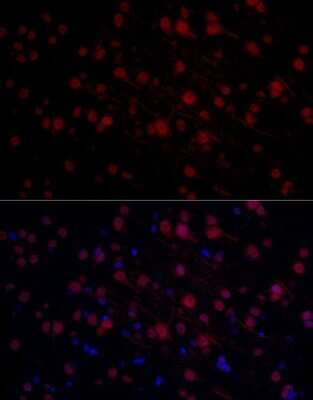 Immunohistochemistry: n-Myc Antibody - BSA Free [NBP2-95112]