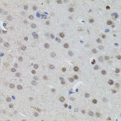 Immunohistochemistry-Paraffin: n-Myc Antibody - BSA Free [NBP2-95112]