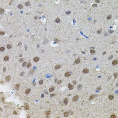 Immunohistochemistry-Paraffin: n-Myc Antibody - BSA Free [NBP2-95112]