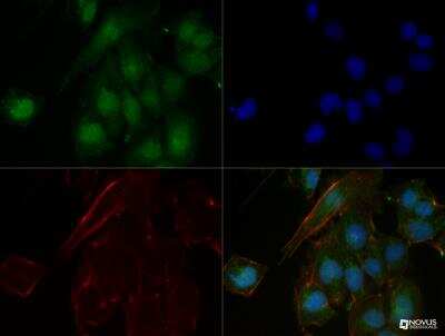 Immunocytochemistry/ Immunofluorescence: n-Myc Antibody (NMYC-1) - BSA Free [NB200-109]
