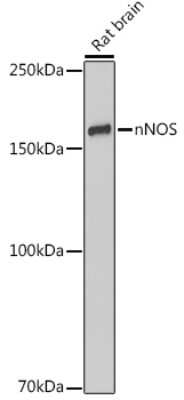 Western Blot: nNOS Antibody (5K9R2) [NBP3-16008]