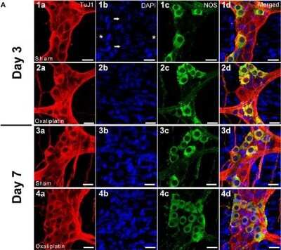 Immunocytochemistry/ Immunofluorescence: nNOS Antibody [NB100-858]