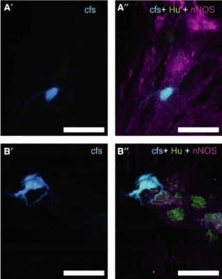 Immunocytochemistry/ Immunofluorescence: nNOS Antibody [NB100-858]