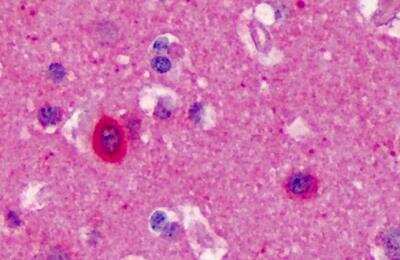 Immunohistochemistry-Paraffin: nNOS Antibody [NB100-858]
