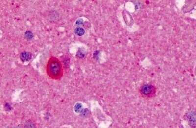 Immunohistochemistry-Paraffin: nNOS Antibody [NBP1-39681]