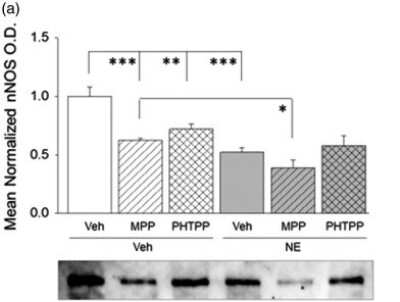 Western Blot: nNOS Antibody [NBP1-39681]