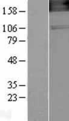 Western Blot: nNOS Overexpression Lysate [NBL1-13719]