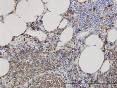 Immunohistochemistry-Paraffin: nSMase Antibody (2C9) [H00006610-M01]