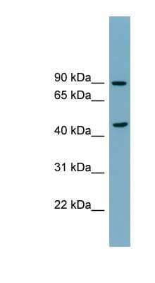 Western Blot: nSMase Antibody [NBP1-59936]