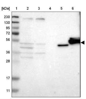 Western Blot: nSMase Antibody [NBP1-87810]