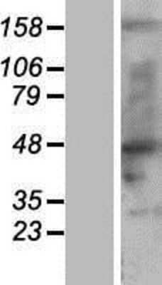 Western Blot: nSMase Overexpression Lysate [NBP2-10865]