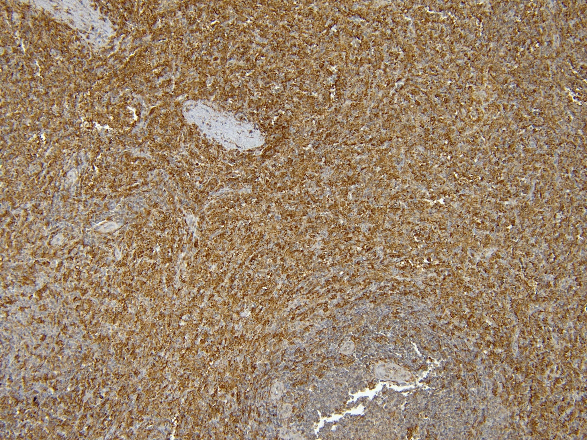 Immunohistochemical Staining of AIF-1/Iba1 in Paraffin Embedded Human Spleen