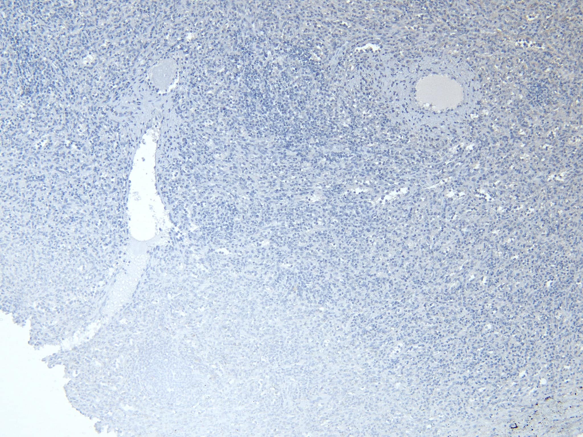 Negative Control Staining of Human Spleen Tissue