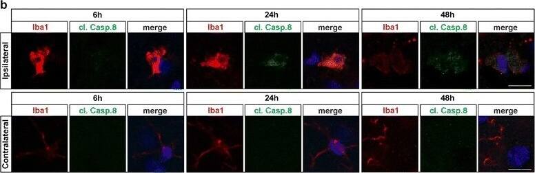 AIF-1/Iba1 Antibody