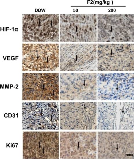 HIF-1 alpha Antibody (H1alpha67)