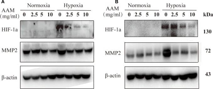 HIF-1 alpha Antibody (H1alpha67)