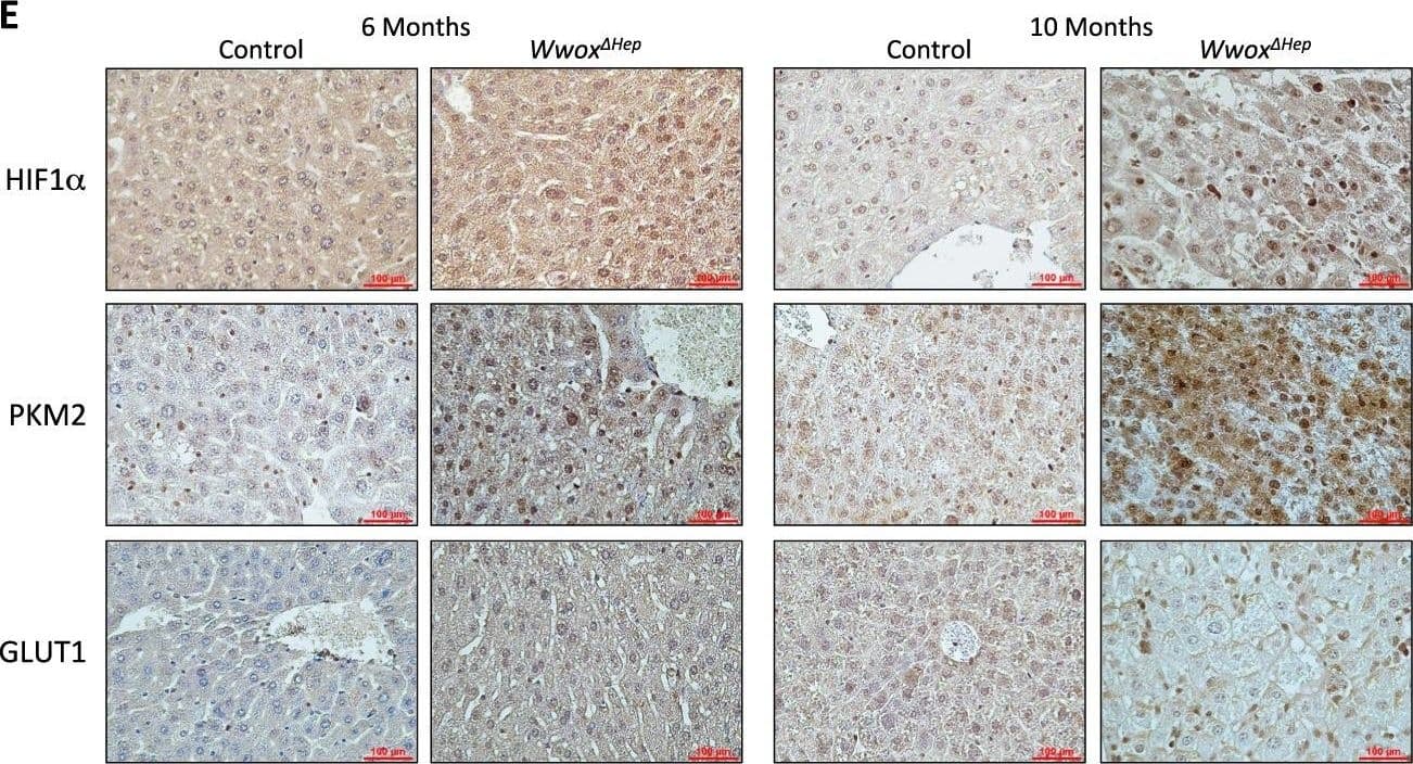 HIF-1 alpha Antibody (H1alpha67)