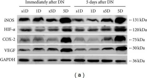 HIF-1 alpha Antibody (H1alpha67)