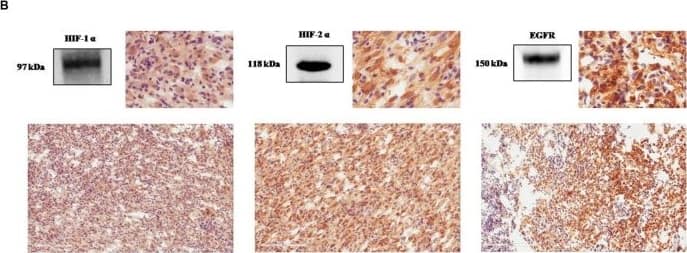 HIF-1 alpha Antibody (H1alpha67)
