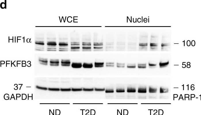 HIF-1 alpha Antibody (H1alpha67)