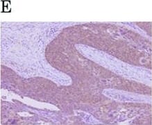 HIF-1 alpha Antibody (H1alpha67)