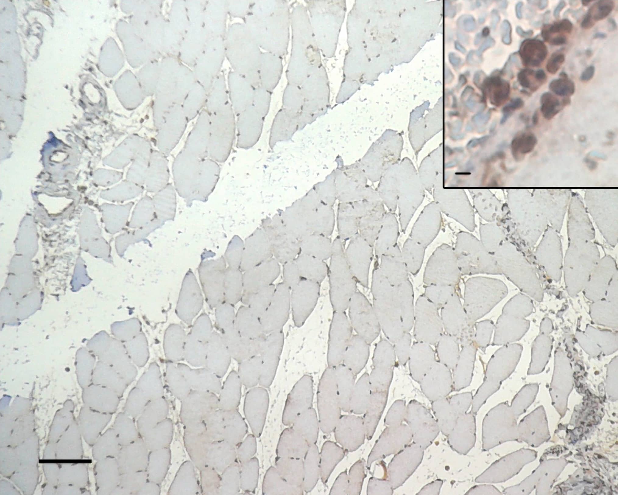 HIF-1 alpha Antibody (H1alpha67)