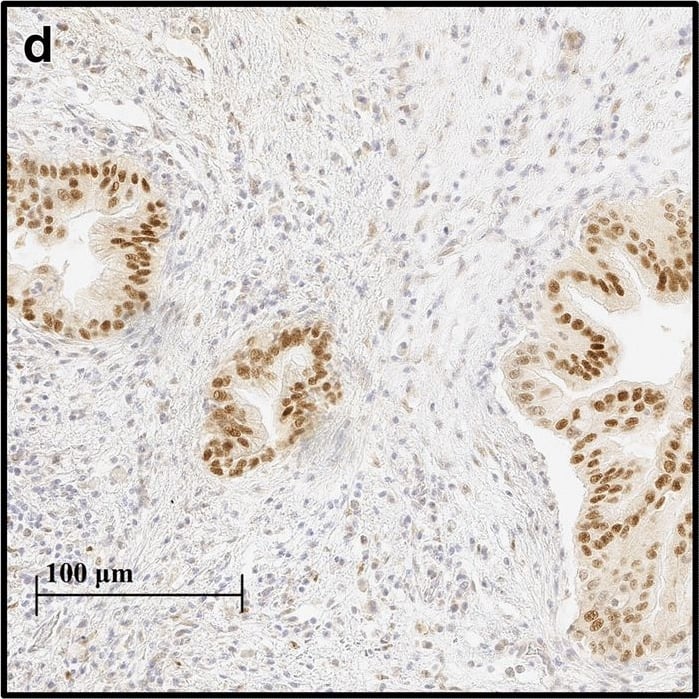 HIF-1 alpha Antibody (H1alpha67)