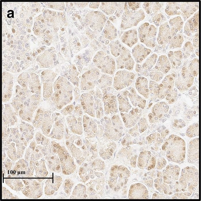 HIF-1 alpha Antibody (H1alpha67)