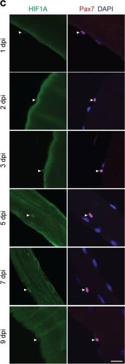 HIF-1 alpha Antibody (H1alpha67)