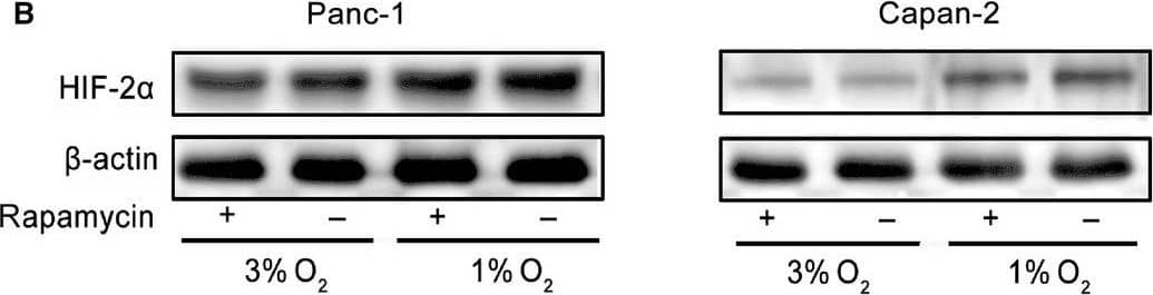 HIF-1 alpha Antibody (H1alpha67)