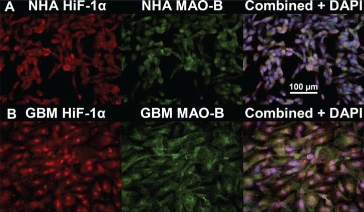 HIF-1 alpha Antibody (H1alpha67)