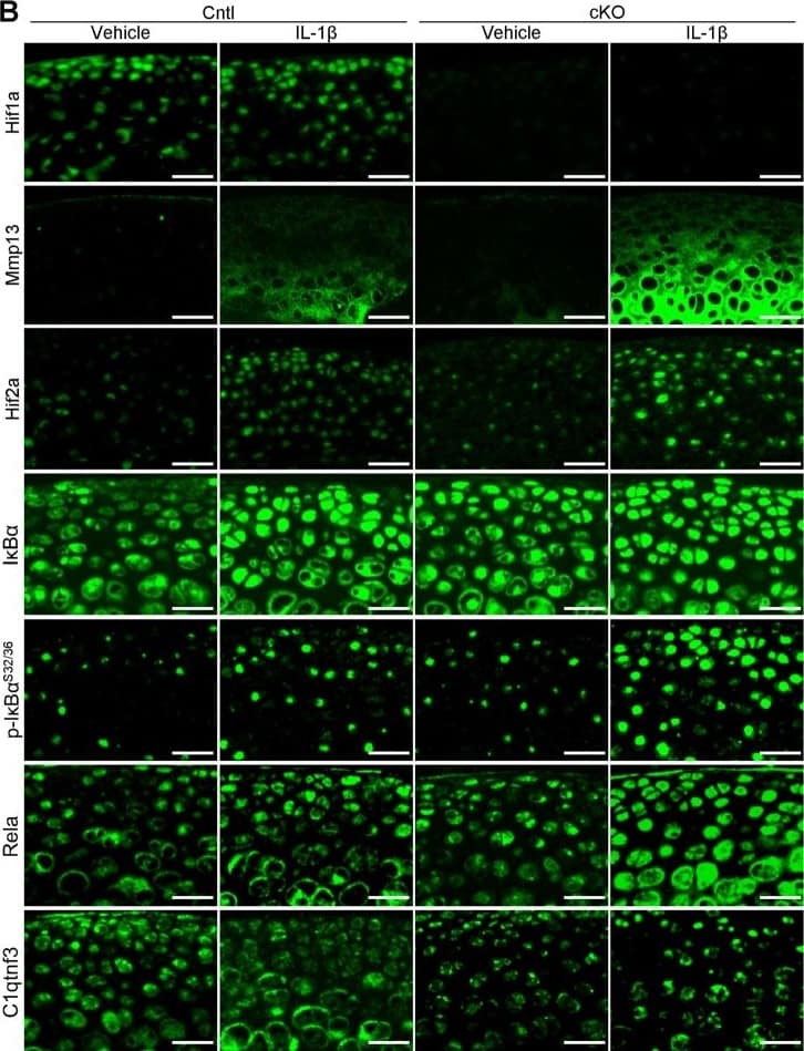 HIF-1 alpha Antibody (H1alpha67)