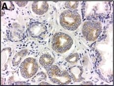 HIF-1 alpha Antibody (H1alpha67)