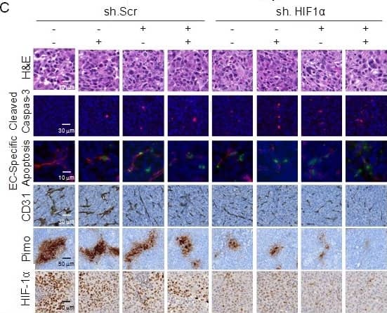 HIF-1 alpha Antibody (H1alpha67)