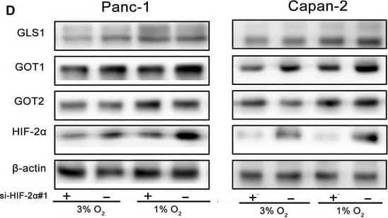 HIF-1 alpha Antibody (H1alpha67)