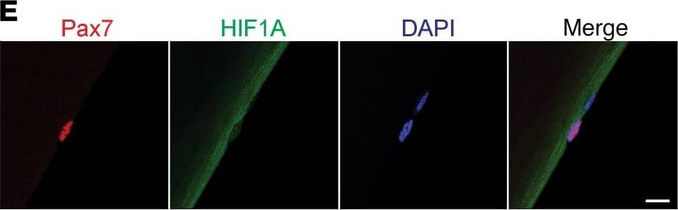 HIF-1 alpha Antibody (H1alpha67)