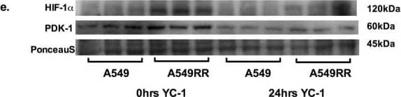 HIF-1 alpha Antibody (H1alpha67)