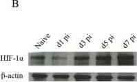 HIF-1 alpha Antibody (H1alpha67)