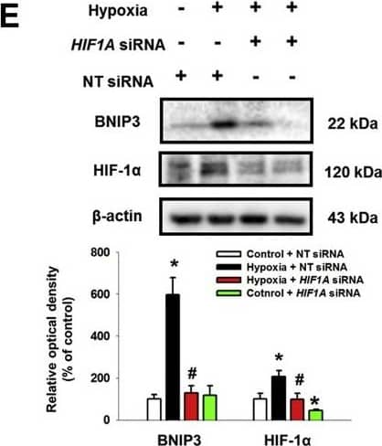 HIF-1 alpha Antibody (H1alpha67)