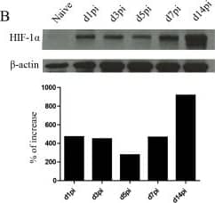 HIF-1 alpha Antibody (H1alpha67)