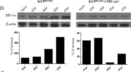 HIF-1 alpha Antibody (H1alpha67)