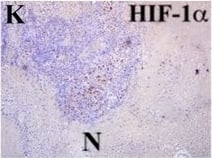 HIF-1 alpha Antibody (H1alpha67)