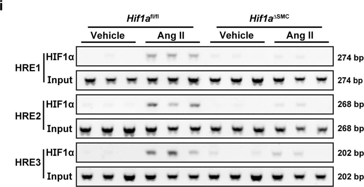 HIF-1 alpha Antibody (H1alpha67)