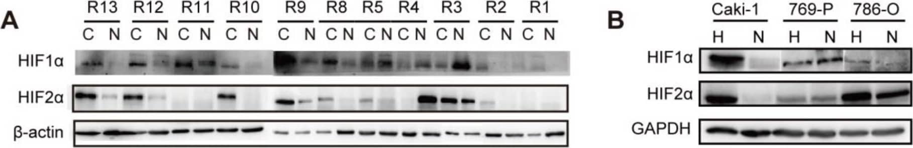 HIF-1 alpha Antibody (H1alpha67)
